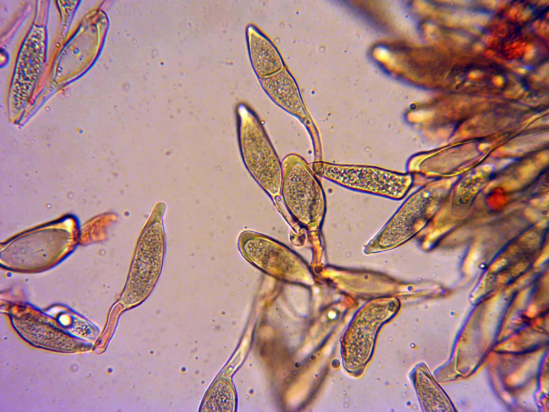 Microscopía de Puccinia malvacearum - 10 -  X 400 3